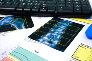 A dexa scan printout next to a desktop keyboard.